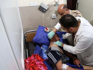 An Iraqi man is treated on March 10, 2016 at the general hospital in the northern Iraqi city of Kirkuk, after he was injured in a rocket attack in the nearby town of Taza.  (AFP/Mohammed Sawaf)