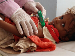 A doctor treats a Yemeni child infected with cholera at a makeshift hospital operated by Doctors Without Borders in Yemen’s Hajjah province. (AFP/ File Photo)