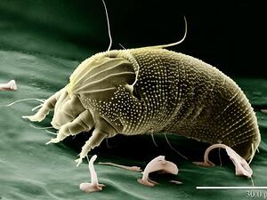 Just a gram (about half a teaspoon) of the fine dust found in AC vents can contain up to 1,000 dust mites. Yuk. (Pixabay)