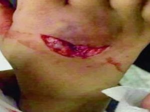 ذئب مفترس ينهش طفلا داخل مول شهير بعرعر