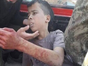 طفل بريء لم يتعد الـ12 من عمره في حلب