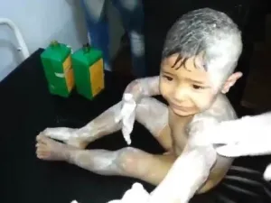 القصف أسفر أيضاً عن إصابة 30 آخرين
