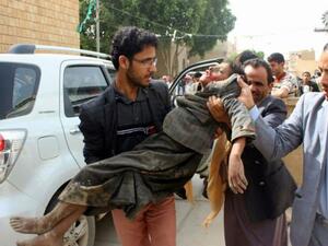 المعسكر الذي استهدفته ضربات التحالف يستخدمه الحوثيون، لتدريب مقاتلين جدد