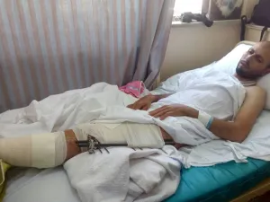 أحد الجرحى الفلسطينين يتلقى العلاج في مستشفى القوات المسلحة الأردنية في عمان

