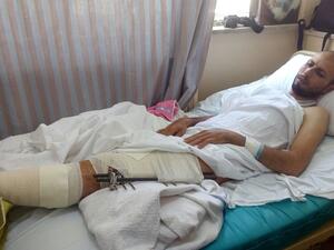 أحد الجرحى الفلسطينين يتلقى العلاج في مستشفى القوات المسلحة الأردنية في عمان
