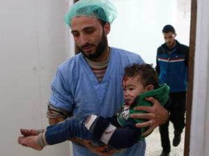 A Syrian child receives treatment at a hospital. (AFP) 