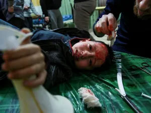 An injured child being treated in a makeshift hospital in Eastern Ghouta (AFP/HAMZA AL-AJWEH)
