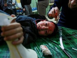 An injured child being treated in a makeshift hospital in Eastern Ghouta (AFP/HAMZA AL-AJWEH)
