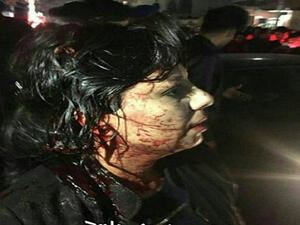  تعليمات الحكومة للحرس الثوري بالضرب بشدة ضد المتظاهرين، وتهديدات القضاء بعقوبات قاسية، أمر غير مقبول