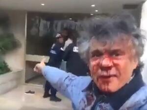 نكاز بعد الاعتداء عليه
