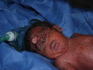The Iraqi baby