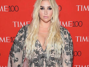 Kesha gained strength from her darkest moments (Source: iiswhoiis / Instagram) 