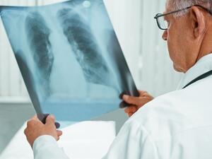 A chest x-ray is one of the best tests for diagnosing pneumonia, HMC experts say. 
