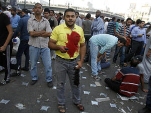 A supporter of the Muslim Brotherhood and Egypt's ousted president Mohamed Morsi stands in a blood-stained shirt as demonstrators gather in Cairo's Abbassiya neighbourhood (AFP/MOHAMMED ABDEL MONEIM)