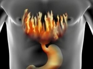 المرضى الذين يستعملون هذه الطريقة لا يستطيعون بعد ذلك إجراء التصوير بالرنين المغناطيسي (أم أر أي) بسبب تداخل الخرزات المغناطيسية مع عمل جهاز التصوير مما قد يسبب أذية للمريض