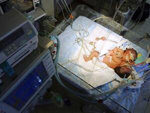The Jordanian mother (now deceased) had just given birth - after a complicated labor- to twin babies when her father entered her sick-bay not to congratulate her but to execute her.