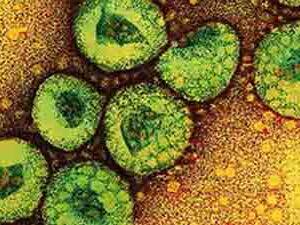 A microscope slide of the deadly SARS virus.
