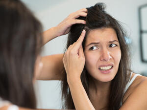 طرق بسيطة لتوديع ظهور القشرة إلى الأبد