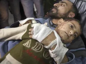 فلسطيني وابنه أصيبا في غارة اسرائيلية على قطاع غزة يوم الاثنين
