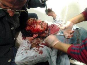 رجل جريح جراء قصف الجيش لحمص يتلقى العلاج في مركز طبي في حي الخالدية في حمص يوم السبت. 