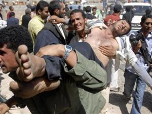 محتجون يحملون مصابا في صنعاء يوم الثلاثاء 
