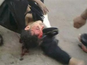 محتج ينزف من جروح في رأسه بعد أن تركه رفاقه على الارض في دمشق للاحتماء من اطلاق النار 
