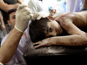 Children are being tortured, even to the point of death in Syria.