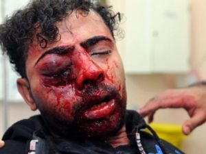 بحريني تعرض لإصابة خلال التظاهرات/أ.ف.ب 