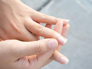 في حال كنتِ مصابة بفقر الدمّ فذلك ينعكس على الأظافر