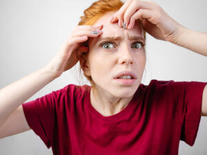 تعد آثار حبوب الوجه من أكثر المشاكل المنتشرة بين الناس (shutterstock.com)