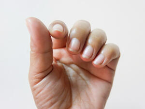 يؤدي التدخين إلى اصفرار الأظافر وفقدانها للحيوية (shutterstock.com)
