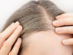 البصل من الأمور الأساسية التي تساعد في التخلص من الشعر الأبيض بسهولة