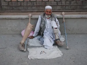 Landmine victim (Shutterstock)