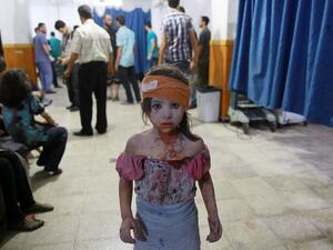 A wounded Syrian girl stands at a makeshift hospital in the rebel-held area of Douma following shelling and air raids by Syrian government forces on Aug. 22, 2015. (AFP/Abed Doumany)