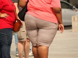 A recent report revealed that 70 percent of men and 75 percent of women suffer from obesity today, which is expected to be responsible for the deaths of over 500,000 people every year. (Pixabay)