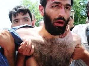 تركيا تحتجز أشخاص بأماكن غير معلومة في ظروف غير إنسانية
