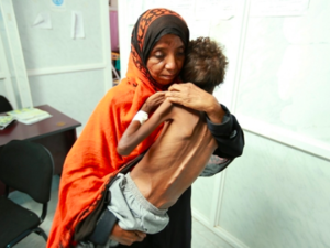  أكثر من 6 آلاف طفل قتلوا أو أصيبوا بجروح خطرة منذ بدء الحرب عام 2015