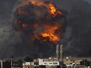 الحرب في اليمن، حسب الهيئات والمنظمات الأممية، تسببت بمقتل وإصابة مئات الآلاف من المدنيين