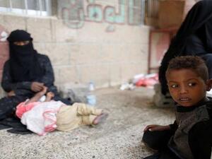 نداء استغاثة لإنقاذ حياة أكثر من 7000 مريض بالفشل الكلوي في صنعاء