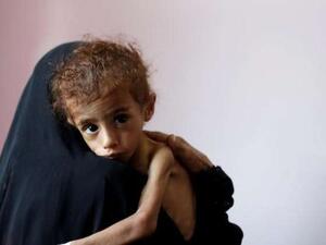 برنامج الأغذية العالمي يغذي حاليا حوالي 8 ملايين شخص شهريا في اليمن