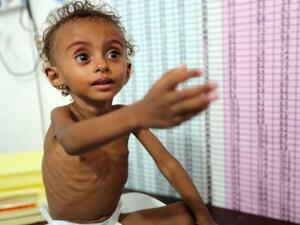 الأمم المتحدة تحذر من تعرض نحو 14 مليون يمني للمجاعة