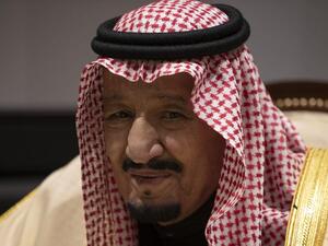 الملك سلمان أجرى منظارا للقولون والنتائج "سليمة"