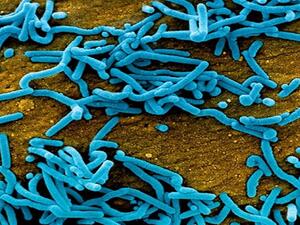 فيروس "ماربورغ" الشبيه بـ"‘إيبولا" يتفشى في غانا