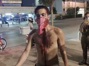 "بلطجية" نتانياهو يهاجمون تظاهرة معارضة له في تل أبيب 