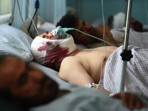 Wounded Afghan men receive treatment at the Wazir Akbar Khan hospital following a car bomb attack in Kabul (AFP)