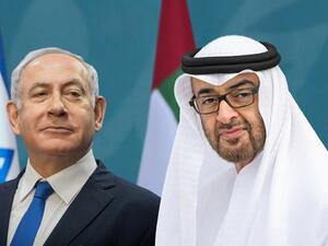 اتفاق بين مشفى إسرائيلي وشركة إماراتية لتطوير تقنيات صحية