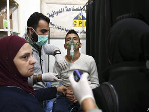 مواطن سوري يتلقى العلاج إثر هجوم كيميائي