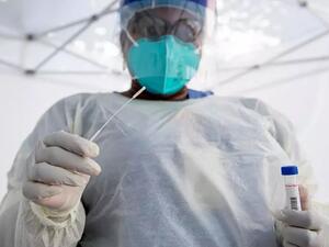 أكثر من 18 مليون إصابة بكوفيد-19 في العالم