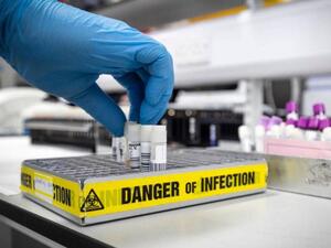 توفير لقاح على نطاق واسع يحتاج وقتا طويلا للتأكد من فعاليته