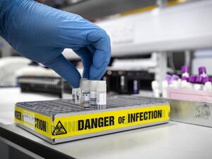 أمريكا تسجل أعلى حصيلة إصابات بكورونا منذ بدء الجائحة